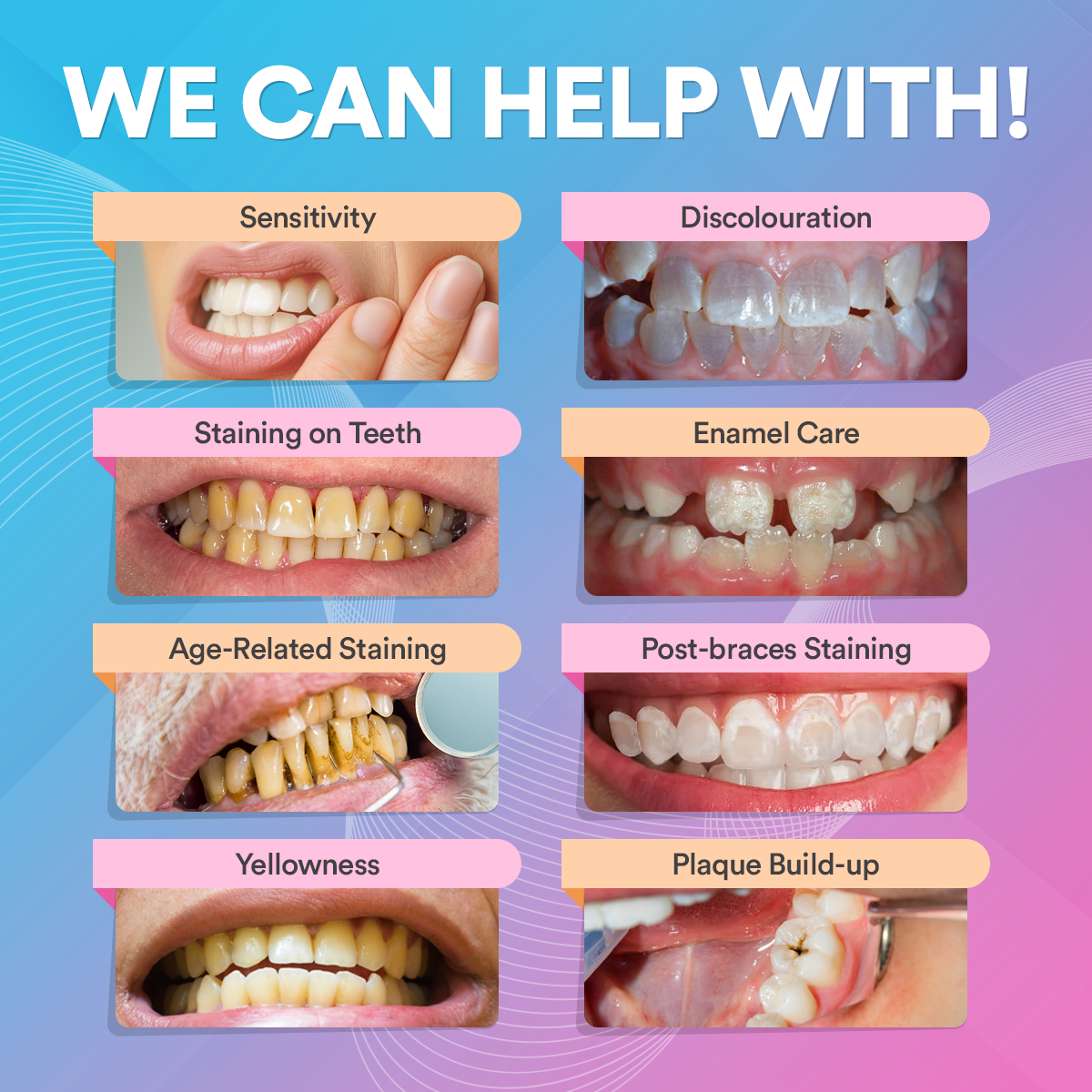 PAP+ tandenbleekset - veganistisch vriendelijk