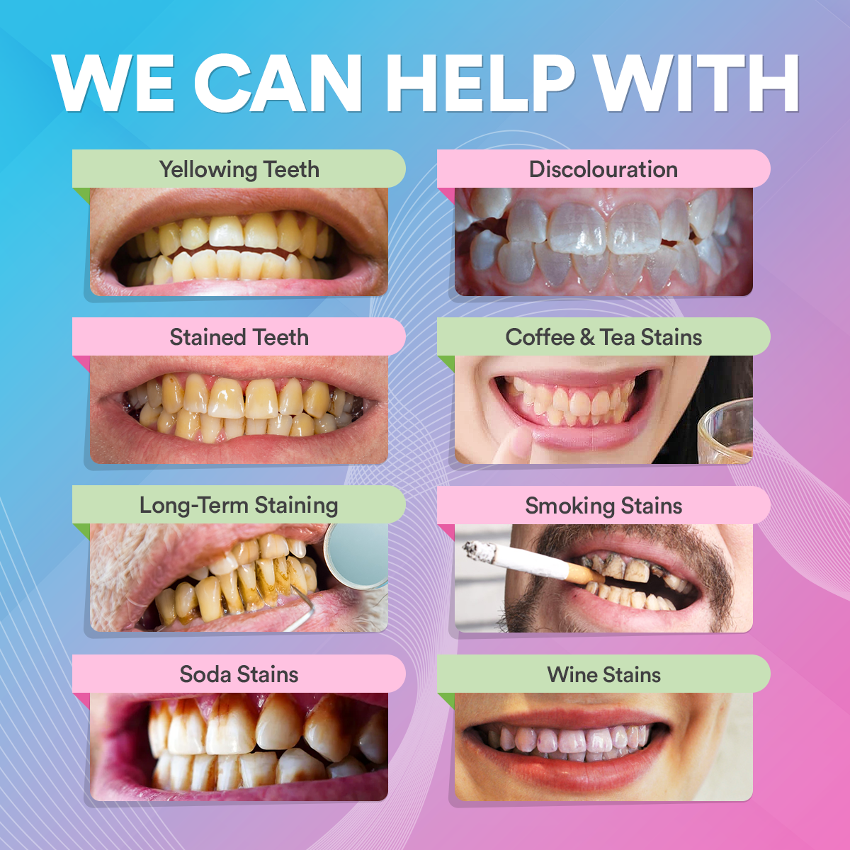 Teeth Whitening Pen DP5