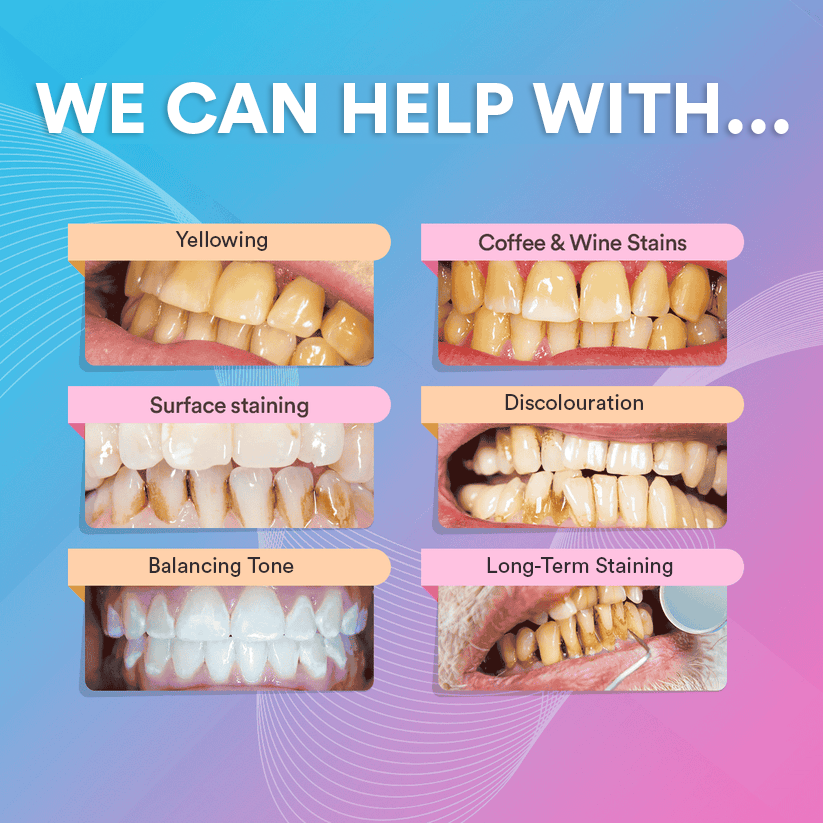 V34 Colour Corrector DP3
