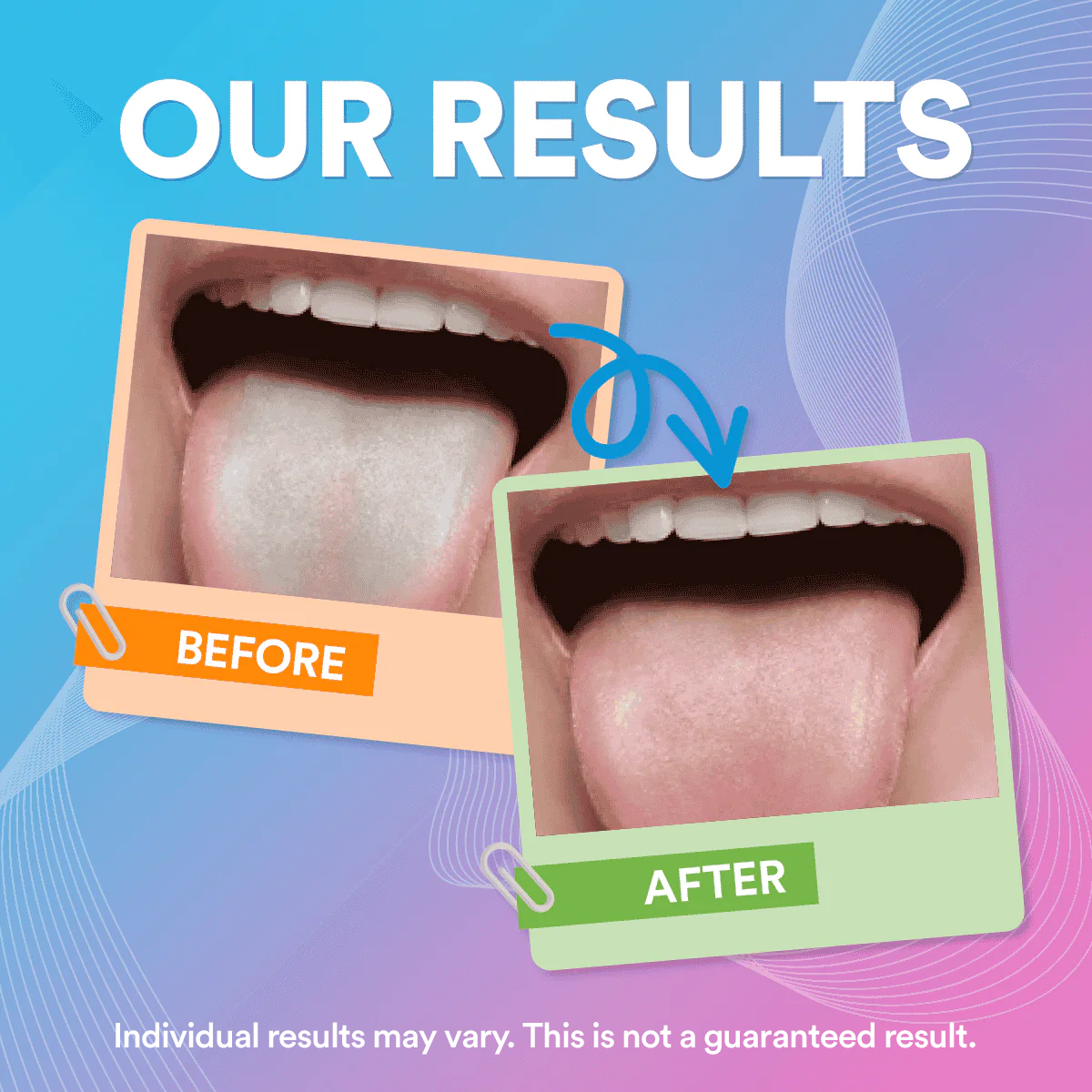 Stainless Steel Tongue Scraper: Durable, Anti-Bacterial, for Fresh Breath & Oral Health, Ergonomic Design, Easy Clean DP7