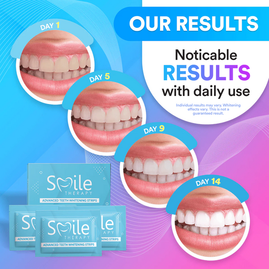 Teeth Cleaning & Whitening Strips (14 Treatments) DP11