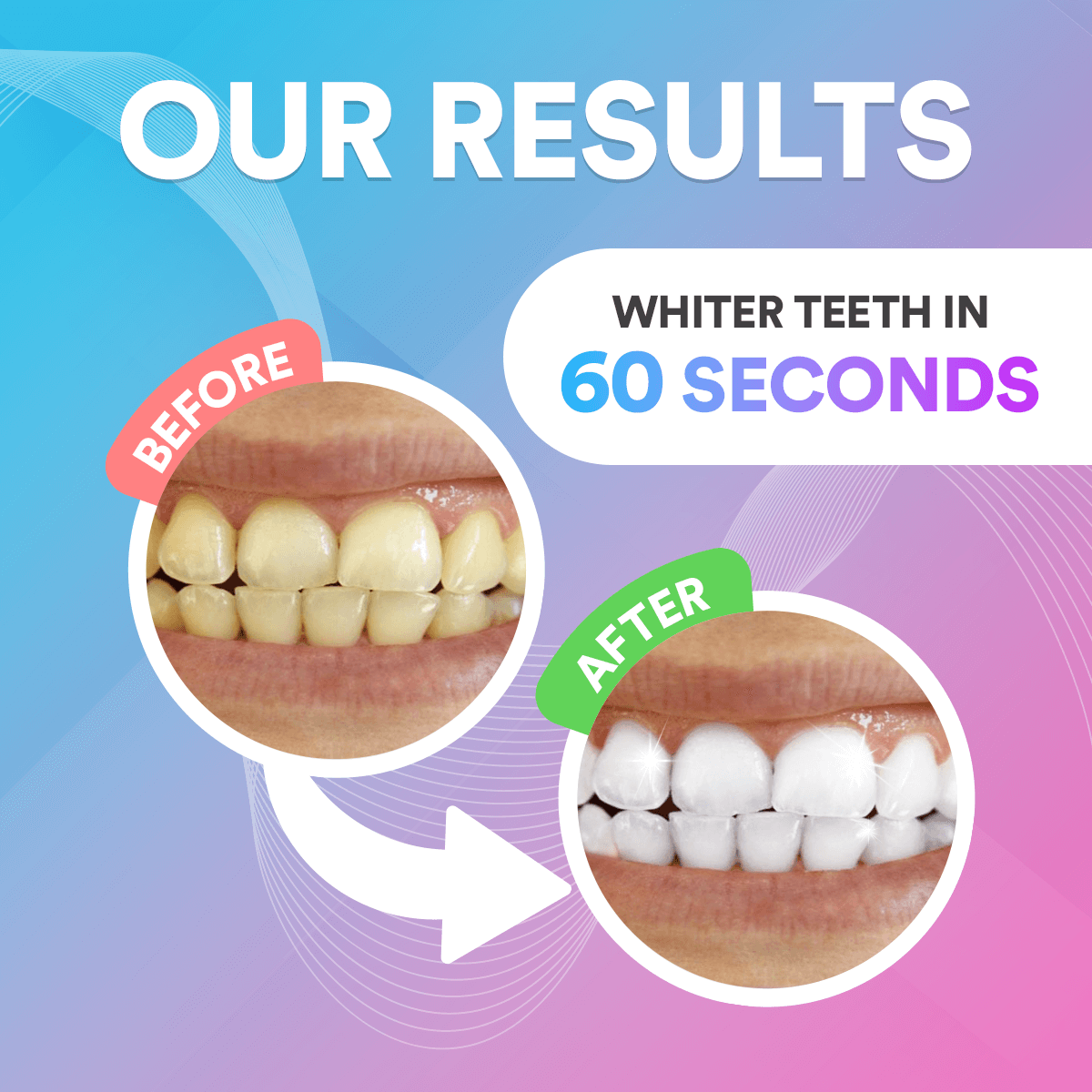 Teeth Whitening Pen DP9