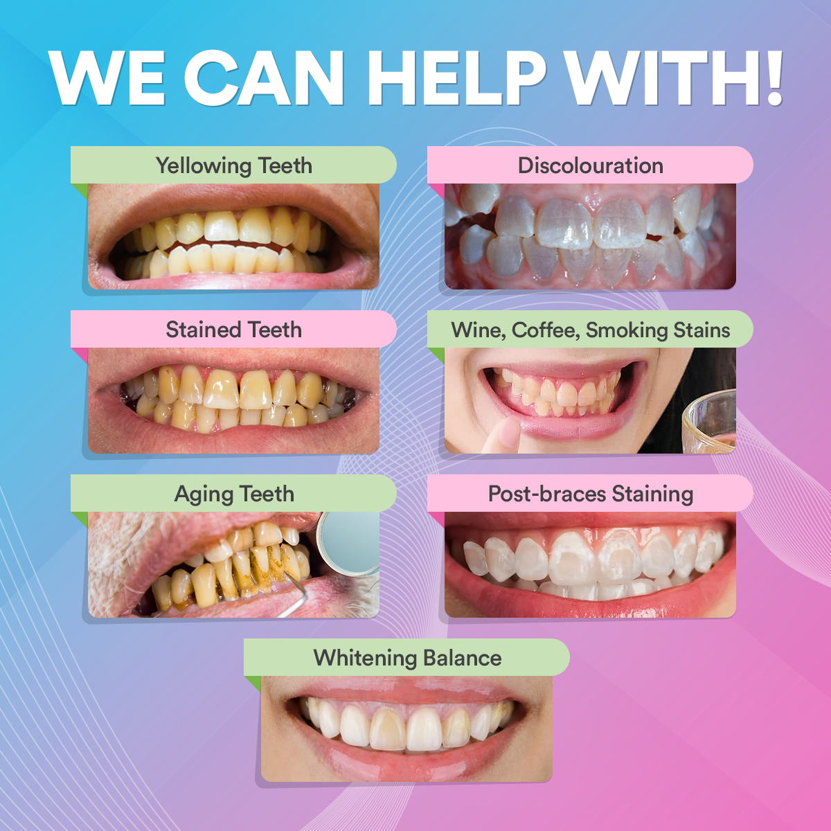 PAP+ Pro Teeth Whitening Powder